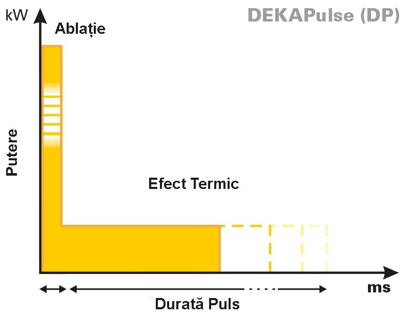 grafic2-DEKAPULSE