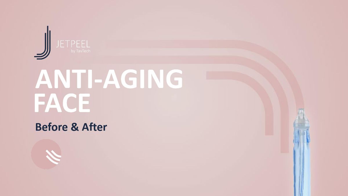 rezultate jetpeel anti-aging