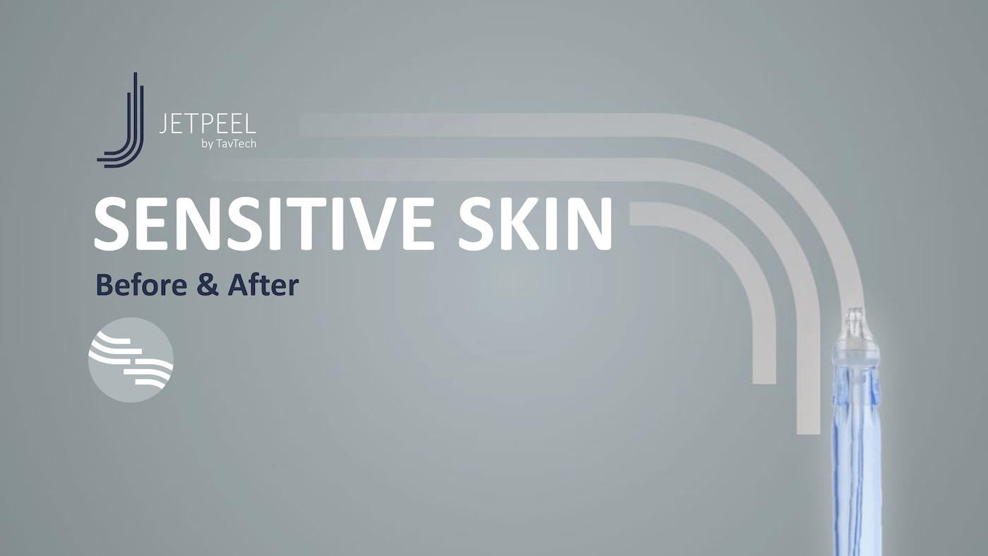 rezultate jetpeel piele sensibila